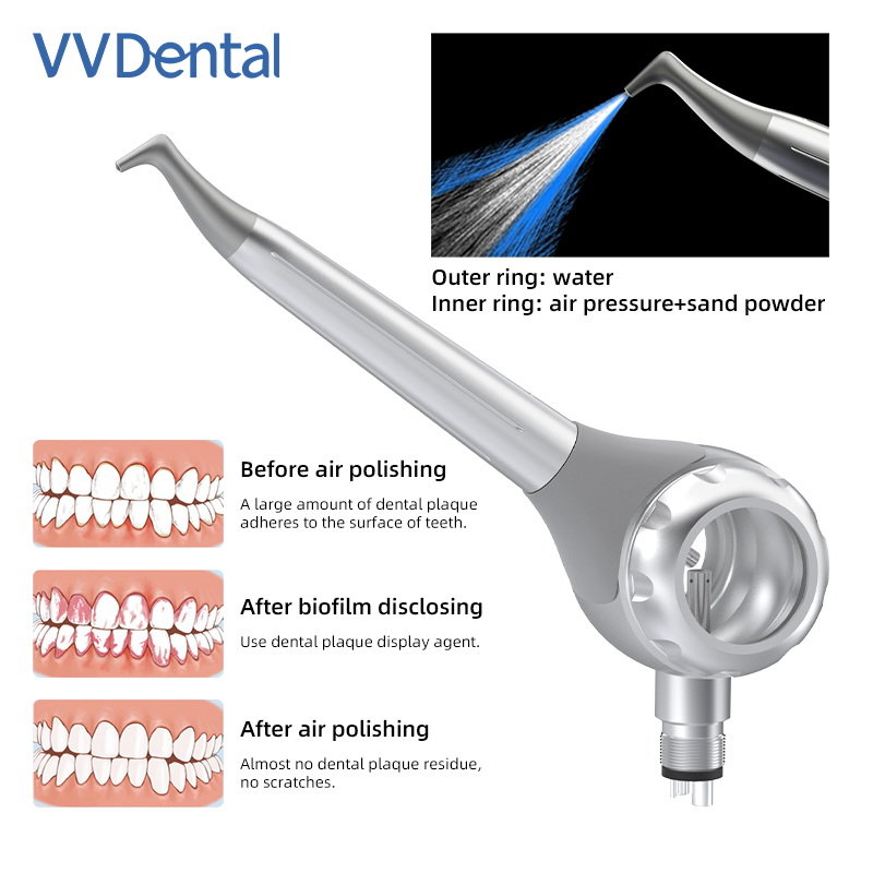 VV Dental 2/4 Lubang Pistol Pe - Teeth Whitening Usa ulasan dan harga