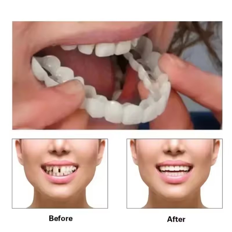 Veneer Gigi Pemutih Gigi Tirua - Teeth Whitening Kit ulasan dan harga