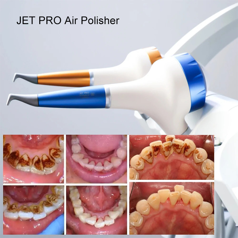VV Dental Air Polishing Prophy - Teeth Whitening Usa ulasan dan harga