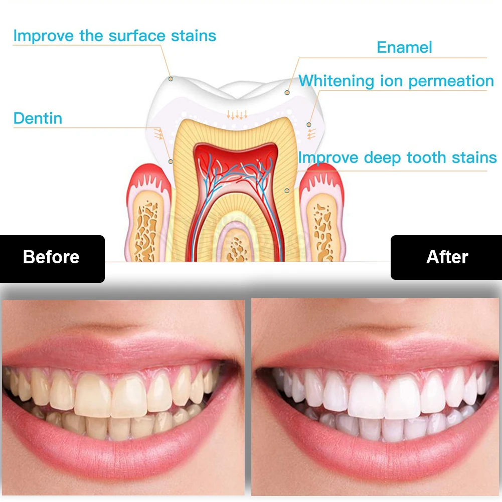 Kit pemutih gigi Mini 16 LED c - Teeth Whitening Accelerator ulasan dan harga